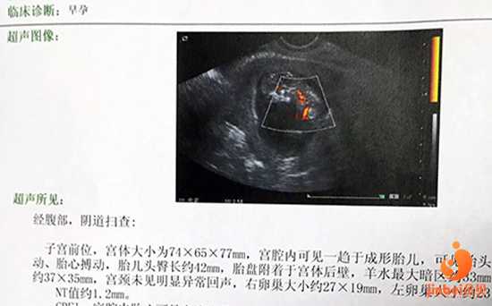 昭通安全的代孕生子,【昆华医院供卵试管婴儿程序】宝贝儿6个月啦，生产完了