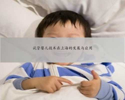 试管婴儿技术在上海的发展与应用
